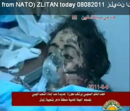 Opfer von NATO-Bombenterror in Libyen, 08.08.2011